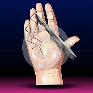 A doctor\'s hand hold the scalpel knife - illustration of scalpels vector - Hand Anatomy - Muscles, Structure