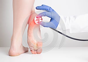 The doctor& x27;s hand in a medical glove holds a stethoscope near the sore heel of a female patient. Heel spur and gout