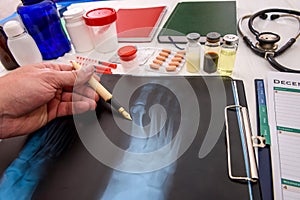 Doctor`s hand pointing at x-ray on the table