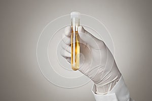 Doctor's hand with urine sample