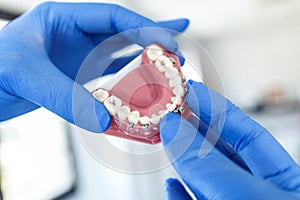 The doctorÃ¢â¬â¢s hands in blue gloves hold an artificial model of the jaw with breaks. The dentist shows an example of tooth photo