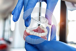 The doctorÃ¢â¬â¢s hands in blue gloves hold an artificial model of the jaw with invisible braces. The dentist shows an example of photo