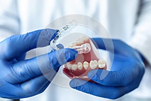 The doctorÃ¢â¬â¢s hands in blue gloves hold an artificial model of the jaw with invisible braces. The dentist shows an example of photo