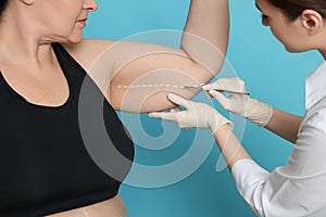 Doctor with scalpel near obese woman on light blue background, closeup. Weight loss surgery