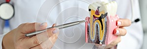 Doctor showing carious cavity with ballpoint pen on plastic artificial tooth model closeup