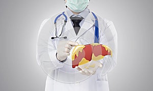 Doctor showing fatty liver , liver disease photo