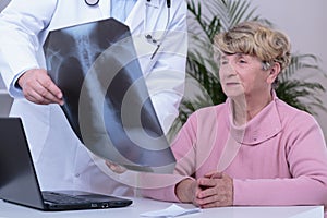 Doctor showing patient chest x-ray