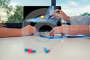 Doctor showing a x-ray of a foot with pain on the top on a laptop to a woman patient. Pills on the desk