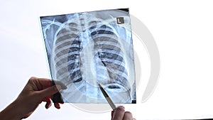 Doctor showing x-ray of patient's lungs.