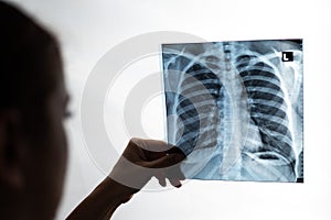 Doctor showing x-ray of patient's lungs.