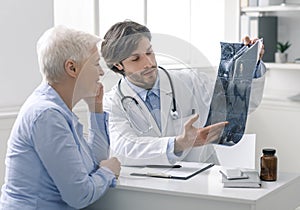 Doctor showing x-ray scans of head to senior female patient