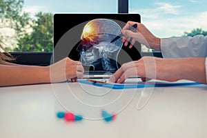 Doctor showing a x-ray of skull with pain in the front of the brain on a laptop to a woman patient. Headache migraine concept