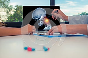 Doctor showing a x-ray of skull with pain in the neck on a laptop to a woman patient. Headache migraine or trauma concept