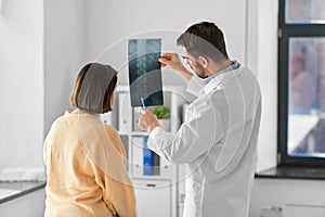 doctor showing x-ray to female patient at hospital