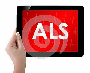 Doctor showing tablet with ALS text.