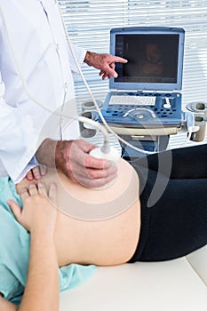 Doctor showing ultrasound monitor to pregnant woman