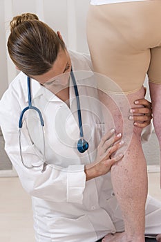 Doctor showing varicose veins from an elderly woman