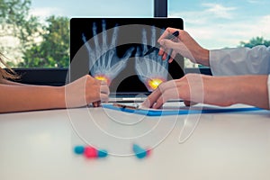 Doctor showing a x-ray of hand with pains on the wrists on a laptop to a woman patient. Pills on the desk. Osteoarthritis concept photo