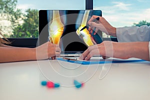 Doctor showing a x-ray of legs with pain in the bones on a laptop to a woman patient. Pills on the desk