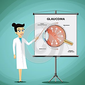 Doctor shows on a blackboard diagram of the human eye. Glaucoma