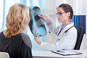 Doctor shows chest x-ray