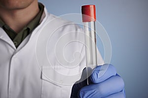 Doctor Shows Empty Blood Tube Container