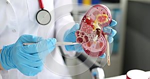 Doctor shows mockup of human kidney in clinic