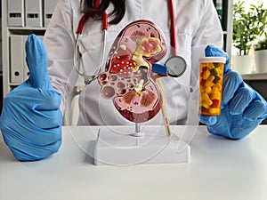 Doctor shows model of kidney and pills