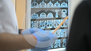 Doctor shows results of tomography pointing by pen to X-rays of skull. General practitioner explains computed