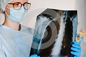 Doctor specialist pulmonary medicine holding radiological, chest x-ray film for medical diagnosis on patient health on infected