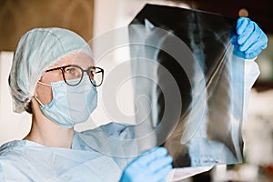 Doctor specialist pulmonary medicine holding radiological, chest x-ray film for medical diagnosis on patient health on infected