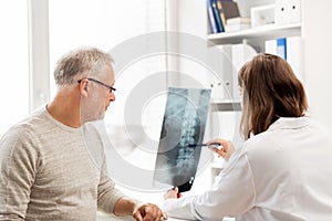Doctor with spine x-ray and senior man at hospital