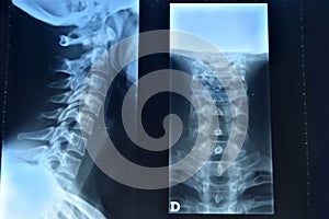 Doctor with stethoscopeRadiographs