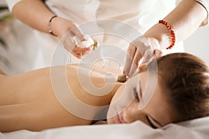 The doctor sticks needles into the woman`s body on the acupuncture