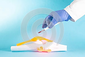 Doctor surgeon holds a scalpel near the knee joint mockup on a blue background. Concept knee surgery, cruciate ligament photo