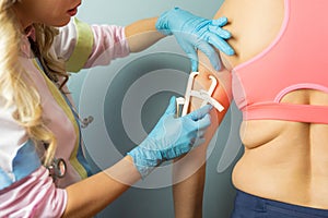 Doctor taking patient`s body fat measurements on arms with fat caliper