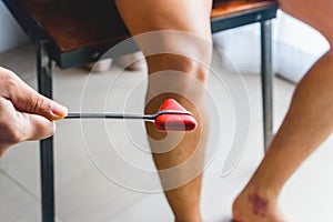 Doctor testing patellar reflex or knee-jerk reflex photo