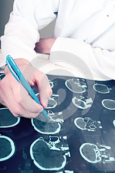 Doctor and tomography