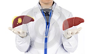 Doctor touch fatty on liver photo