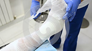 Doctor traumatologist puts a plaster on the broken leg of the patient.