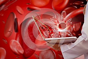 Doctor use laptop computer,research red Blood cells and stem cell human cell,blood vessels background,health care concept