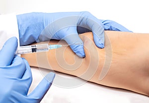 The doctor uses a syringe to take a skin biopsy from the patient. The concept of malignant subcutaneous lesions, close photo