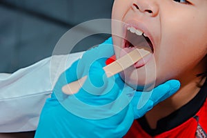 The doctor uses a tongue depressor to examine the child\'s tongue