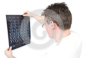 Doctor viewing MRI scans