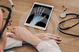 Doctor watching a digital tablet with x-ray of a left hand with pains on the joints of the fingers. Osteoarthritis concept