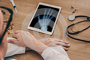 Doctor watching a digital tablet with x-ray of a right hand. Osteoarthritis concept