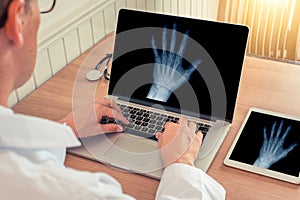 Doctor watching a laptop with x-ray of a left hand in a medical office. Osteoarthritis concept