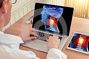 Doctor watching a laptop with x-ray of a 3D skull head with pain relief in the neck in a medical office. Headache migraine concept