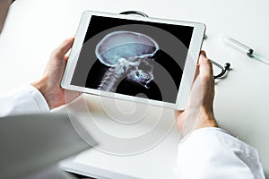 Doctor watching a x-ray of brain on digital tablet. Radiology concept