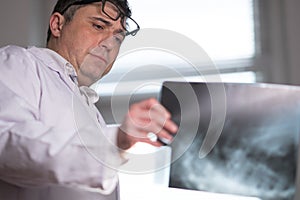 Doctor wearing a white lab coat examining X-ray images